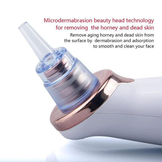 Blackhead Instrument Electric Suction Facial Washing Instrument Beauty Acne Cleaning Blackhead Suction Instrument by GJG Denim