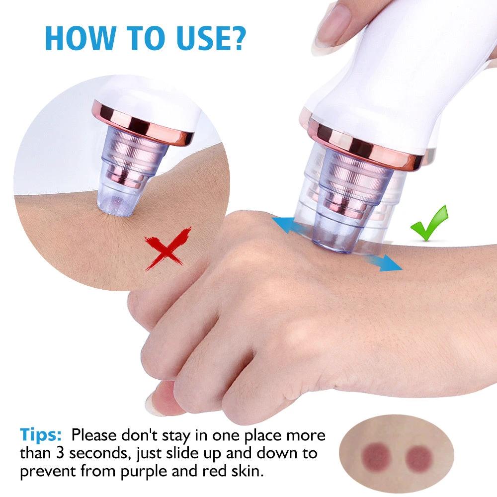 Blackhead Instrument Electric Suction Facial Washing Instrument Beauty Acne Cleaning Blackhead Suction Instrument by GJG Denim